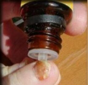 Нанасяне на капки върху засегнат от гъбички нокът на крака